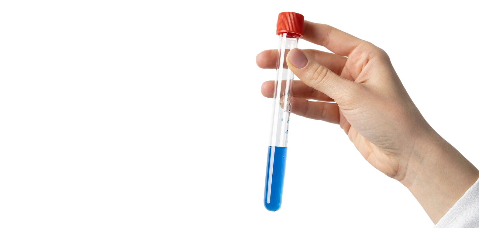 Аллергодиагностика Immunocap