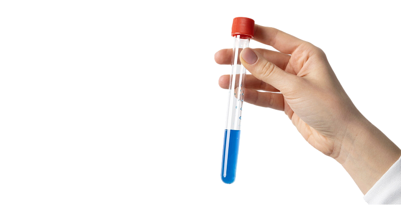 Аллергодиагностика Immunocap