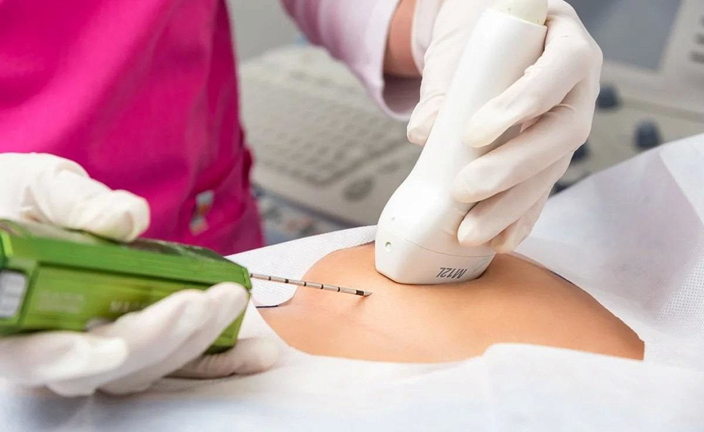 Biopsiya v mammologii v klinike Evrodon
