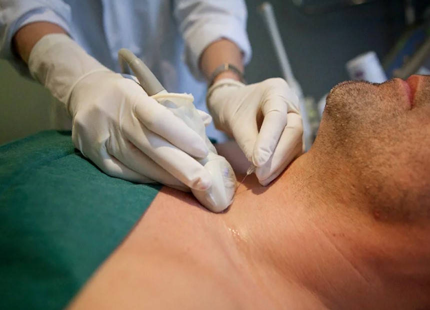 Biopsiya schitovidnoi jelezi v klinike Evrodon 